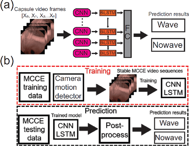 Figure 3 for Detecting and measuring human gastric peristalsis using magnetically controlled capsule endoscope