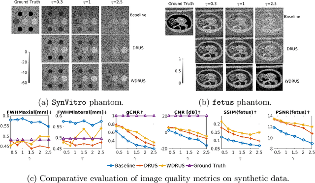 Figure 3 for Ultrasound Image Reconstruction with Denoising Diffusion Restoration Models