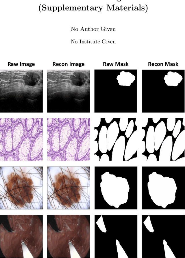 Figure 3 for Generative Medical Segmentation