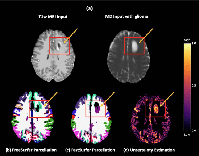 Figure 1 for EVENet: Evidence-based Ensemble Learning for Uncertainty-aware Brain Parcellation Using Diffusion MRI