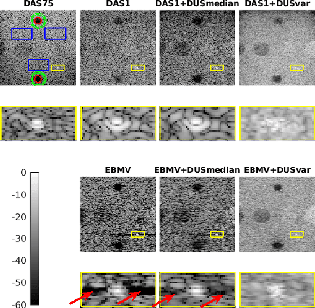 Figure 2 for Ultrasound Image Enhancement with the Variance of Diffusion Models