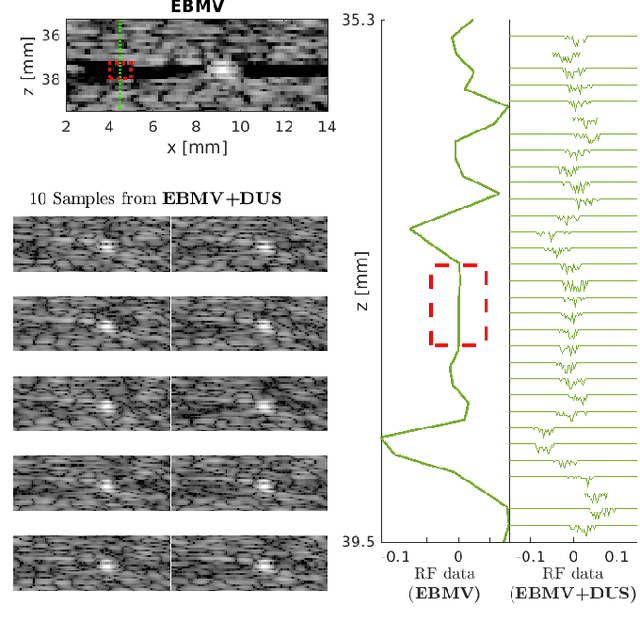 Figure 3 for Ultrasound Image Enhancement with the Variance of Diffusion Models