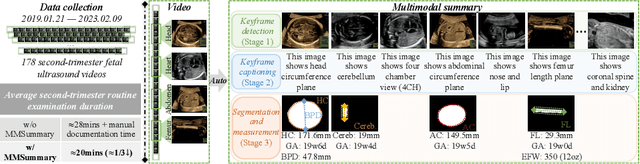 Figure 1 for MMSummary: Multimodal Summary Generation for Fetal Ultrasound Video