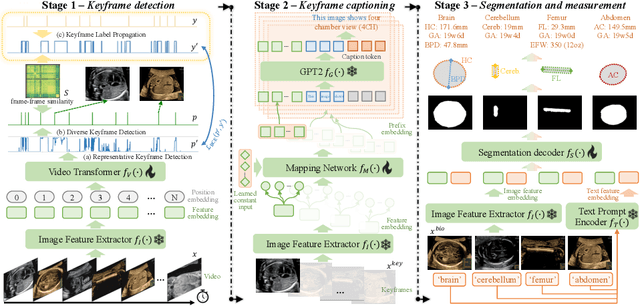 Figure 3 for MMSummary: Multimodal Summary Generation for Fetal Ultrasound Video