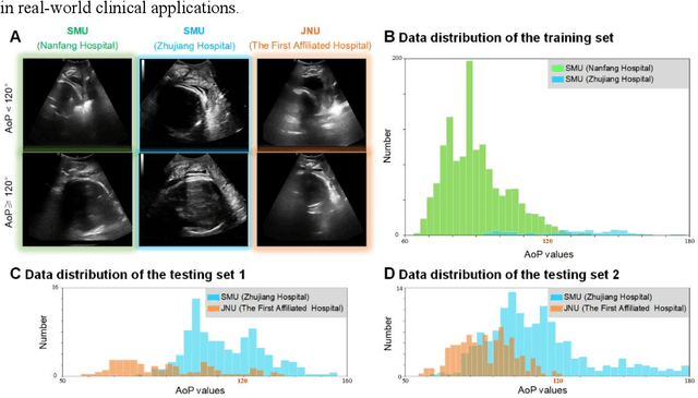 Figure 3 for PSFHS Challenge Report: Pubic Symphysis and Fetal Head Segmentation from Intrapartum Ultrasound Images