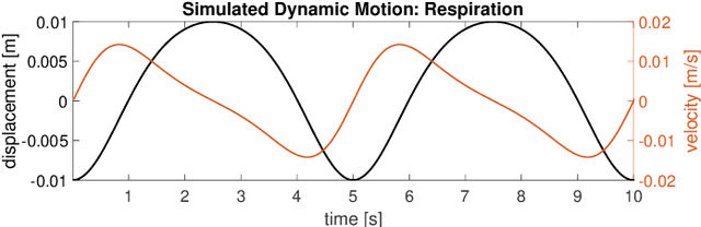 Figure 1 for On Models and Approaches for Human Vital Signs Extraction from Short Range Radar Signals