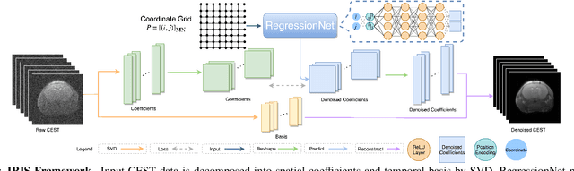 Figure 1 for Implicit Regression in Subspace for High-Sensitivity CEST Imaging