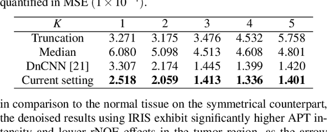 Figure 4 for Implicit Regression in Subspace for High-Sensitivity CEST Imaging