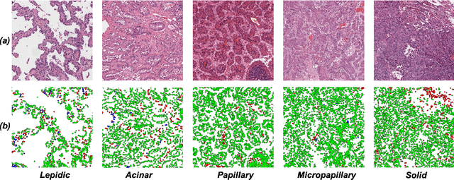 Figure 1 for Cell Maps Representation For Lung Adenocarcinoma Growth Patterns Classification In Whole Slide Images