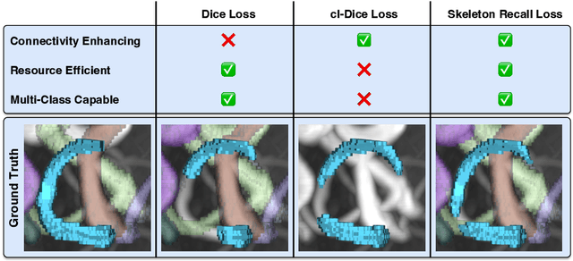 Figure 3 for Skeleton Recall Loss for Connectivity Conserving and Resource Efficient Segmentation of Thin Tubular Structures