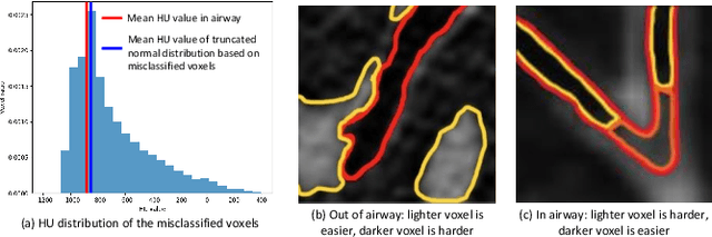 Figure 1 for Intensity Confusion Matters: An Intensity-Distance Guided Loss for Bronchus Segmentation