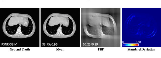 Figure 2 for DPER: Diffusion Prior Driven Neural Representation for Limited Angle and Sparse View CT Reconstruction