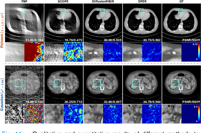 Figure 3 for DPER: Diffusion Prior Driven Neural Representation for Limited Angle and Sparse View CT Reconstruction