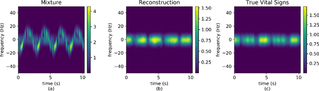 Figure 3 for Interference Motion Removal for Doppler Radar Vital Sign Detection Using Variational Encoder-Decoder Neural Network