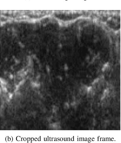 Figure 1 for Hand Gesture Classification Based on Forearm Ultrasound Video Snippets Using 3D Convolutional Neural Networks