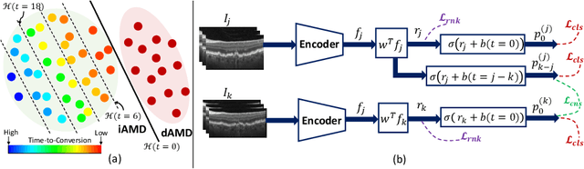 Figure 1 for Forecasting Disease Progression with Parallel Hyperplanes in Longitudinal Retinal OCT