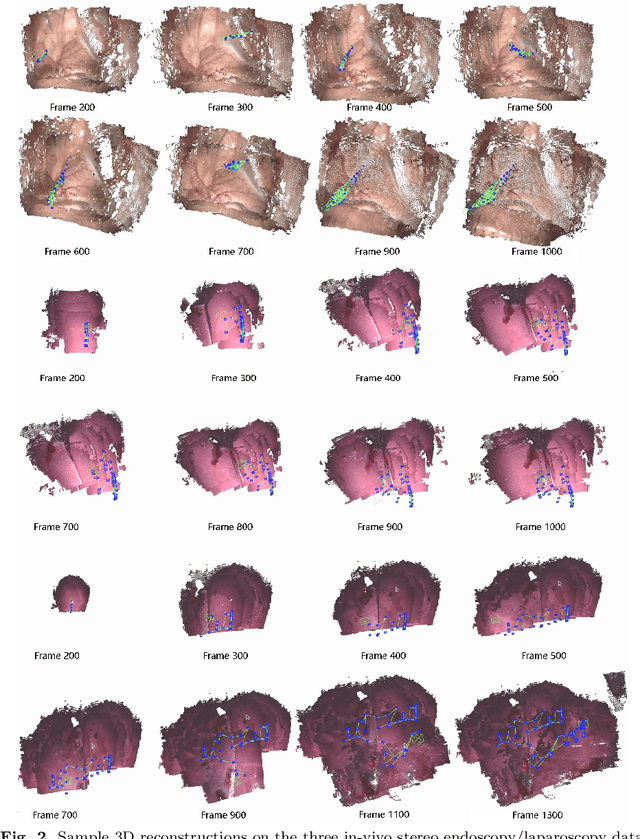 Figure 3 for BDIS-SLAM: A lightweight CPU-based dense stereo SLAM for surgery