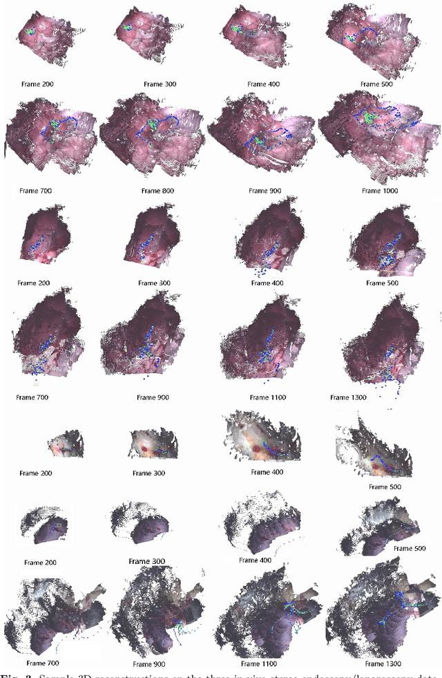 Figure 4 for BDIS-SLAM: A lightweight CPU-based dense stereo SLAM for surgery