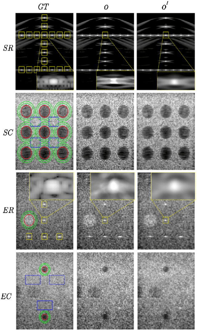 Figure 4 for Compact Implicit Neural Representations for Plane Wave Images