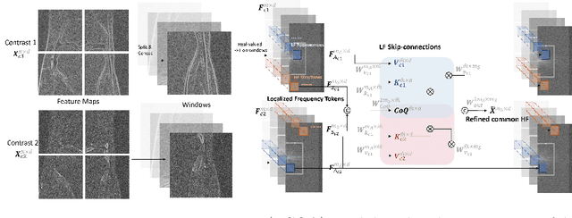 Figure 3 for SGSR: Structure-Guided Multi-Contrast MRI Super-Resolution via Spatio-Frequency Co-Query Attention