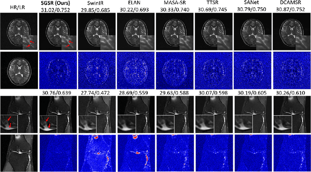 Figure 4 for SGSR: Structure-Guided Multi-Contrast MRI Super-Resolution via Spatio-Frequency Co-Query Attention