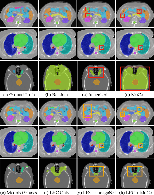 Figure 3 for Localized Region Contrast for Enhancing Self-Supervised Learning in Medical Image Segmentation