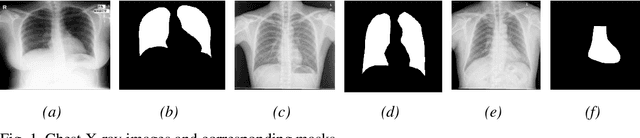 Figure 1 for K-SAM: A Prompting Method Using Pretrained U-Net to Improve Zero Shot Performance of SAM on Lung Segmentation in CXR Images