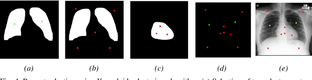 Figure 4 for K-SAM: A Prompting Method Using Pretrained U-Net to Improve Zero Shot Performance of SAM on Lung Segmentation in CXR Images