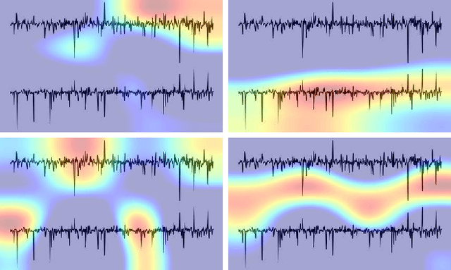 Figure 3 for Twins-PainViT: Towards a Modality-Agnostic Vision Transformer Framework for Multimodal Automatic Pain Assessment using Facial Videos and fNIRS