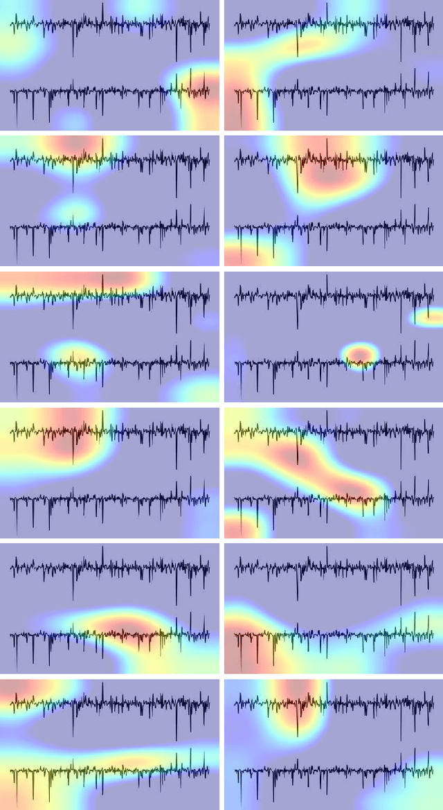 Figure 4 for Twins-PainViT: Towards a Modality-Agnostic Vision Transformer Framework for Multimodal Automatic Pain Assessment using Facial Videos and fNIRS