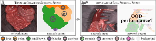 Figure 1 for Semantic segmentation of surgical hyperspectral images under geometric domain shifts