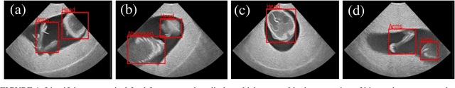 Figure 1 for FPUS23: An Ultrasound Fetus Phantom Dataset with Deep Neural Network Evaluations for Fetus Orientations, Fetal Planes, and Anatomical Features