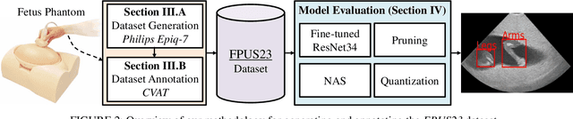 Figure 3 for FPUS23: An Ultrasound Fetus Phantom Dataset with Deep Neural Network Evaluations for Fetus Orientations, Fetal Planes, and Anatomical Features