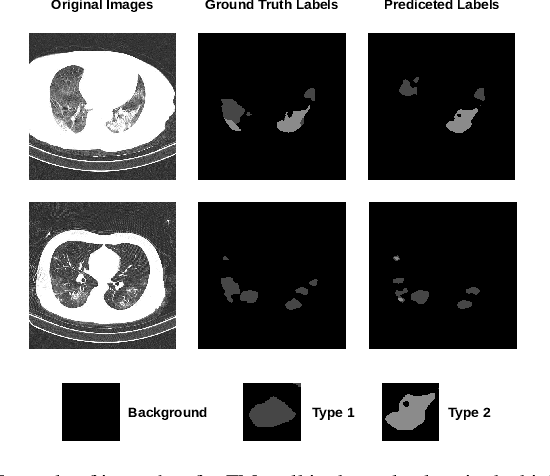 Figure 2 for ForestMonkey: Toolkit for Reasoning with AI-based Defect Detection and Classification Models