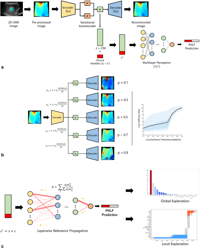 Figure 3 for Methodological Explainability Evaluation of an Interpretable Deep Learning Model for Post-Hepatectomy Liver Failure Prediction Incorporating Counterfactual Explanations and Layerwise Relevance Propagation: A Prospective In Silico Trial