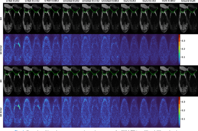 Figure 4 for CAMP-Net: Context-Aware Multi-Prior Network for Accelerated MRI Reconstruction