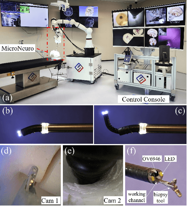 Figure 2 for Design and Visual Servoing Control of a Hybrid Dual-Segment Flexible Neurosurgical Robot for Intraventricular Biopsy