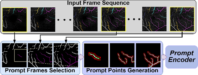 Figure 2 for SAM-OCTA2: Layer Sequence OCTA Segmentation with Fine-tuned Segment Anything Model 2