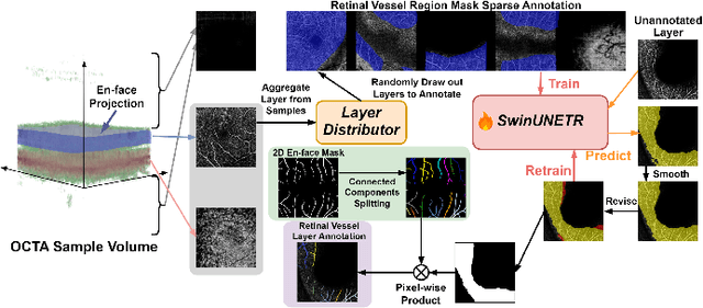 Figure 3 for SAM-OCTA2: Layer Sequence OCTA Segmentation with Fine-tuned Segment Anything Model 2