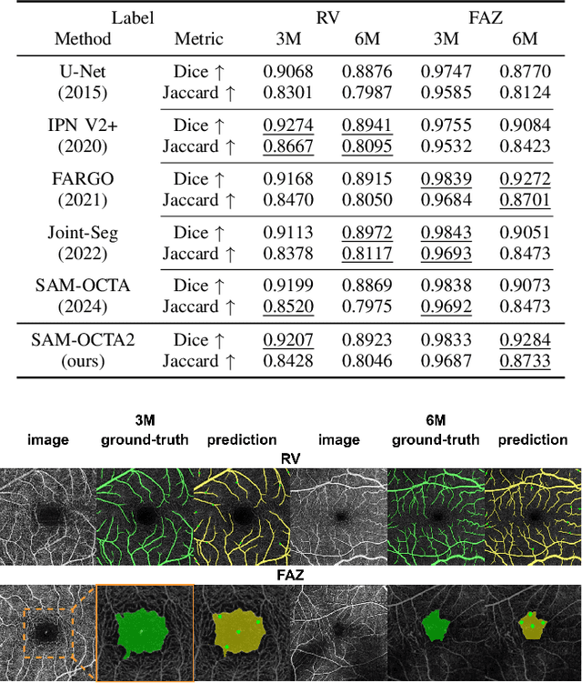 Figure 4 for SAM-OCTA2: Layer Sequence OCTA Segmentation with Fine-tuned Segment Anything Model 2