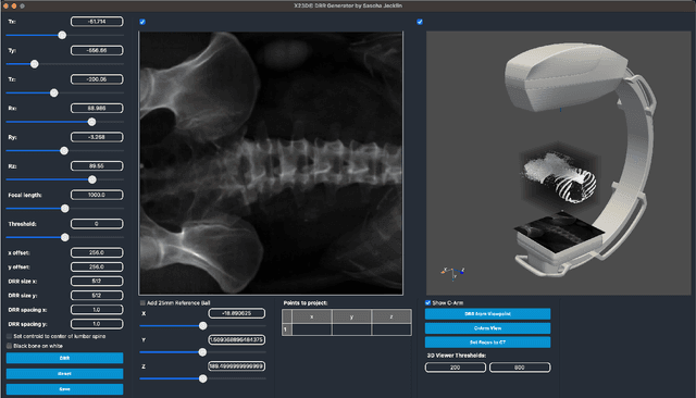 Figure 1 for Domain adaptation strategies for 3D reconstruction of the lumbar spine using real fluoroscopy data