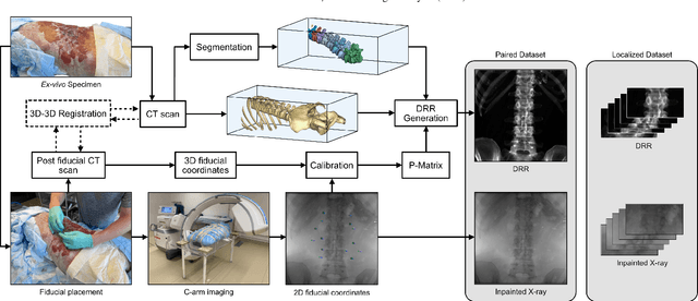 Figure 3 for Domain adaptation strategies for 3D reconstruction of the lumbar spine using real fluoroscopy data