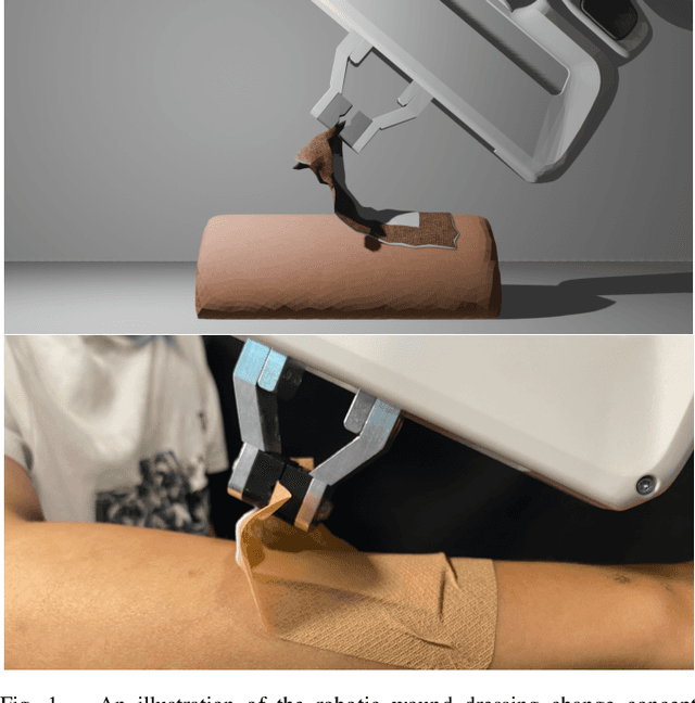 Figure 1 for AutoPeel: Adhesion-aware Safe Peeling Trajectory Optimization for Robotic Wound Care