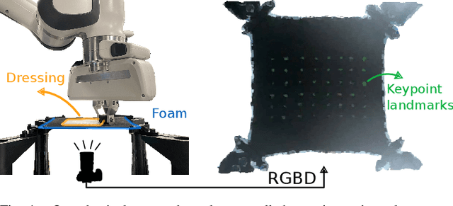 Figure 4 for AutoPeel: Adhesion-aware Safe Peeling Trajectory Optimization for Robotic Wound Care