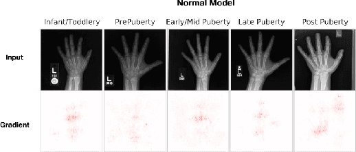 Figure 2 for Post hoc Explanations may be Ineffective for Detecting Unknown Spurious Correlation