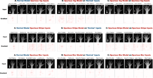 Figure 4 for Post hoc Explanations may be Ineffective for Detecting Unknown Spurious Correlation