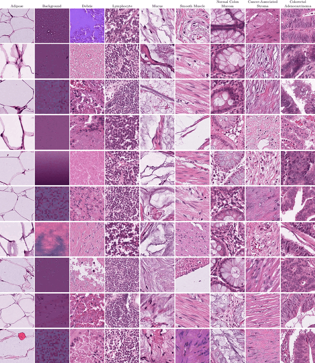 Figure 1 for NCT-CRC-HE: Not All Histopathological Datasets Are Equally Useful