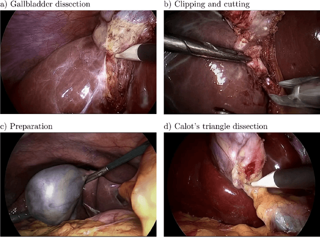 Figure 3 for SurGen: Text-Guided Diffusion Model for Surgical Video Generation