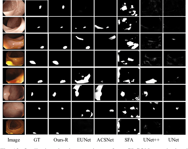 Figure 4 for GLCONet: Learning Multi-source Perception Representation for Camouflaged Object Detection