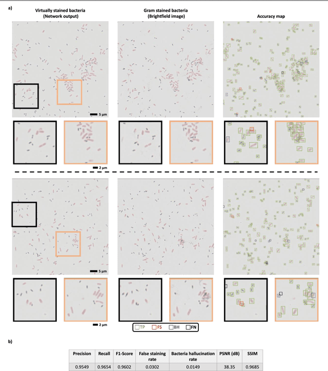 Figure 2 for Virtual Gram staining of label-free bacteria using darkfield microscopy and deep learning